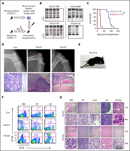 VQ myeloma is readily transplantable to syngeneic secondary recipients. (A) Schematic illustration of VQ myeloma transplantation strategy. (B) VQ1 BM cells (8 × 106; VQ-D1-BM), VQ1 splenocytes (20 × 106; VQ-D1-SP), VQ2 BM cells (5 × 106; VQ-D2-BM), or VQ2 LN cells (20 × 106; VQ-D2-LN) were transplanted into individual recipients. SPEP was performed on recipient mice bled at the moribund stage. The brackets show the γ-globulin component of the serum. The donor cells were isolated from BM, spleen (SP), or LN. (C) Kaplan-Meier survival curves of VQ-D1 and VQ-D2 recipient mice, which were transplanted with VQ1 and VQ2 myeloma cells, respectively. Log-rank test was performed. **P < .01. (D) Representative radiographic images and H&E-stained sections of hind-limb bones from moribund VQ-D1 and VQ-D2 recipient mice and age-matched control mice; scale bar, 50 μm. The red arrows indicate the osteolytic lesions. (E) Representative photo of VQ-D1/D2 recipients with hind-limb paralysis. (F) Flow cytometric analysis of B220 and CD138 expression on BM, SP, and LN cells from VQ-D1 and VQ-D2 recipient mice. Representative density plots are shown. (G) Representative images of H&E-stained BM, SP, liver, LN, and kidney sections; scale bar, 40 μm.