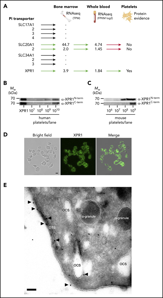 XPR1 is a major phosphate transporter on platelets. (A) Data from the Human Protein Atlas project and GTEx Analysis V7 (https://gtexportal.org) were used to determine the expression of transcripts encoding for the 10 reported phosphate transporters in bone marrow and whole blood. Platelet Web (http://plateletweb.bioapps.biozentrum.uni-wuerzburg.de/plateletweb.php) and PubMed were used to establish whether protein expression on platelets had been described. TPM, transcripts per million. Cell membranes from the indicated number of human (B) or mouse (C) platelets were analyzed by western blot, using antibodies directed against the XPR1 N- or C-terminal portions. Lysed HEK293 cells transiently transfected with a pCHIX-XPR1–coding plasmid were loaded as a positive control (XPR1). (D) Bright-field image (left), confocal laser scanning image (middle; green) of XPR1 staining in nonpermeabilized resting human platelets, and merged image (right). Scale bar, 1 µm. (E) Transmission electron microscopy of immunogold-stained (10-nm particles) XPR1 on human platelets. Open canalicular system (OCS), dense tubular system (DTS), and α-granules are shown. Arrows indicate XPR1; scale bar, 100 nm.