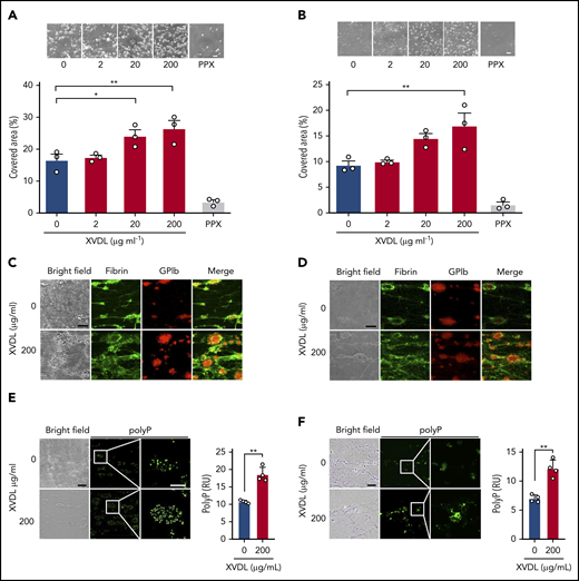 Targeting XPR1 promotes thrombus formation in blood under flow. Citrated human whole-blood preincubated with XVDL (2-200 μg/ml; 4 hours) or PPX (2 mg/ml; 30 minutes) was readjusted to physiological Ca2+ and Mg2+ concentrations and perfused for 4 minutes over a collagen-coated surface at an arterial (1000 per second) (A) or venous (100 per second) (B) shear rate. Representative phase-contrast images (top) of thrombi formed during perfusion after incubation with the indicated XVDL concentrations. Scale bars, 10 µm. Bar graphs indicate the percentage of surface area covered by thrombi. Mean ± SD; n = 3. Comparisons were performed using 1-way analysis of variance and Tukey’s multiple comparison test; *P < .05, **P < .01. (C-D) Representative bright-field and immunofluorescence images of thrombi formed at t = 4 minutes under arterial (C) or venous (D) flow. Staining for fibrin (59D8; green) and platelets (GPIb; red) and merged images are shown. Scale bars, 10 μm. (E-F) Bright-field and immunofluorescence images of thrombi formed at t = 4 minutes under arterial (E) or venous (F) flow. Representative images of 6 individual experiments. Scale bars, 10 μm. PolyP signal (PPX_Δ12, green) was quantified from 4 randomly selected high-power images by ImageJ. **P < .01, by Student t test. RU, reflectance units.