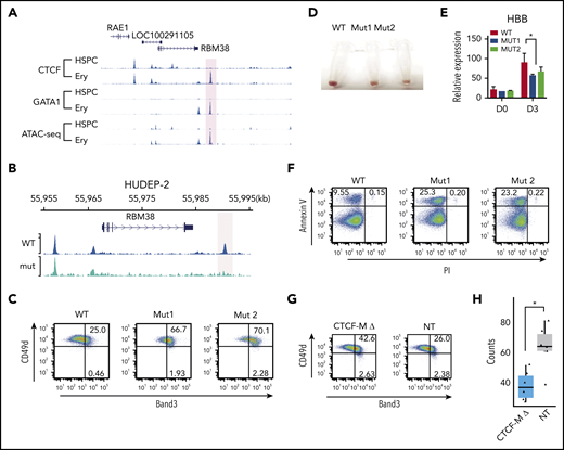 Disrupting dynamic CTCF binding leads to abnormal hematopoiesis. (A) Signal tracks for CTCF and GATA1 ChIP-seq and ATAC-seq at the RBM38 gene locus in HSPCs and erythroblasts. The dynamic site that was genome edited to remove the CTCF motif is highlighted. (B) CTCF ChIP-seq signals in WT HUDEP-2 cells (WT) and HUDEP-2 cells with a 19-bp deletion of the CTCF motif near RBM38 promoter (mut) after 3 days of inducted erythroid maturation. The dynamic CTCF site that harbors the deleted motif is highlighted. (C) Representative flow cytometric plot of Band3 and CD49d expression in gated CD235a+ WT HUDEP-2 cells and 2 mut clones after 3 days of induced maturation. (D) Cell pellets of WT HUDEP-2 cells and 2 mut clones after 4 days of induced maturation. (E) Relative expression level of HBB in WT HUDEP-2 cells and 2 mut clones, as compared with GAPDH before differentiation (D0) and 3 days after induced maturation (D3). D0, n = 2; D3, n > 3. *P < .05, paired 1-tailed t test. (F) Representative flow cytometric plot of annexin V and propidium iodide expression in WT HUDEP-2 cells and 2 mut clones after 3 days of induced maturation. (G) Genome-edited CD34+ cells were grown in erythroid differentiation medium for 12 days. Representative flow cytometric plots of Band3 and CD49d levels in gated CD235a+ cells. (H) Genome-edited CD34+ cells were seeded onto methylcellulose. Box plot shows the numbers of burst-forming unit–erythroid colonies after 14 days in culture. n = 6, *P < .01, unpaired 2-tailed t test. NT, nontargeting control gRNA; PI, propidium iodide.