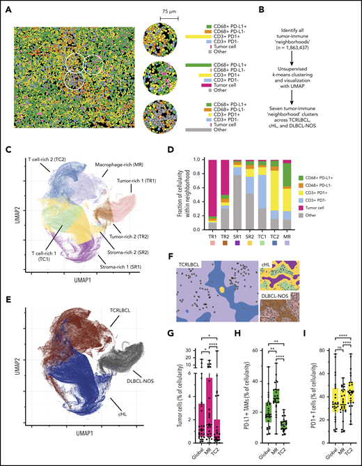 Spatially defined immune cell neighborhoods distinguish TCRLBCL from cHL and DLBCL-NOS. (A) Representative cell phenotype map generated from a 5-marker mIF panel (CD3, PAX5, CD68, PD-1, and PD-L1), which highlights PD-L1+ TAMs, PD-L1− TAMs, PD-1+ T cells, PD-1− T cells, malignant B cells, and other cell types (original magnification, ×20). Circles surround the cellular neighborhoods of 3 representative “anchor” cells (yellow with red outline). Neighborhoods are defined by calculating the fractional composition of cell types <75 μm radial distance surrounding each anchor cell. (B) Neighborhood analysis workflow, which included unsupervised k-means clustering of all cell neighborhoods (n = 1 863 437) defined across cases of TCRLBCL (n = 26), cHL (n = 19), and DLBCL-NOS (n = 18) and assigned to 1 of 7 neighborhood clusters. (C) UMAP plot of pooled neighborhood data from TCRLBCL, cHL, and DLBCL-NOS cases with the 7 clusters color-coded. (D) Fractional composition of cell types within each of 7 defined clusters, color-coded. (E) UMAP plot from panel C colored according to the underlying pathologic diagnosis and demonstrating segregation of cell-neighborhoods from cases of TCRLBCL (red), cHL (blue), and DLBCL-NOS (black) into distinct regions. (F) Projections of color-coded neighborhoods (according to panel C) onto the original mIF images for representative cases of TCRLBCL (left, same case as shown in panel A), cHL (top right panel), and DLBCL-NOS (bottom right panel). Malignant cells are denoted by circles. (G-I) Percentage of global and neighborhood-specific cellularity in TCRLBCL comprised of malignant B cells (G), PD-L1+ TAMs (H), and PD-1+ T cells (I). (G-I) Individual cases (●) and the median (line), 25th and 75th percentiles (boxes), and extreme values (whiskers) are indicated. Statistical comparisons by the Friedman test with Dunn’s test for multiple comparisons. *P < .05; **P < .01; ****P < .0001.