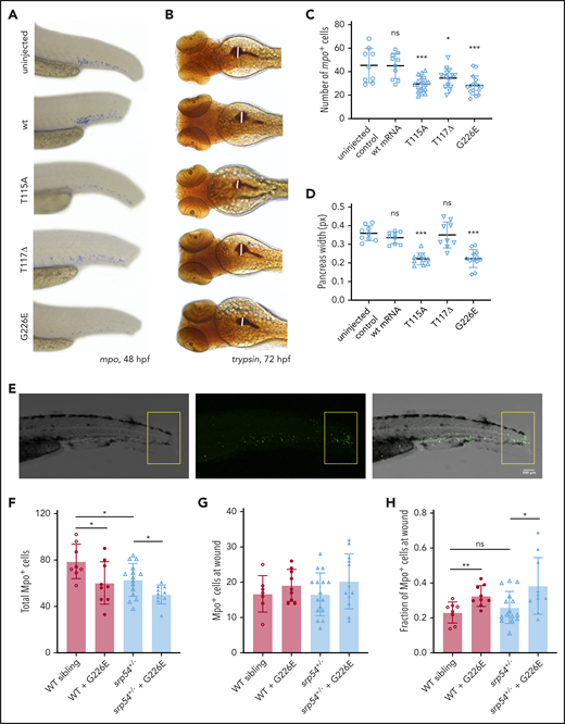 Injections of mutated mRNAs into srp54+/− embryos induce an SDS-like phenotype, but the residual neutrophils are sufficient to be adequately recruited to injury sites. (A-D) Injection of T115A, T117Δ, or G226E human mRNA into srp54+/− embryos. (A-B) Representative images with (C-D) corresponding quantifications after WISH for mpo (A,C) and trypsin (B,D). (E) Fluorescent confocal microscopy images 8 hours after tail fin injury. Left, bright field; middle, fluorescence; right, merge. Yellow rectangle indicates the analyzed tail region. (F-H) Quantification of neutrophil migration of WT siblings, WT siblings injected with human G226E mRNA, srp54+/−, and srp54+/− zebrafish injected with human G226E mRNA. (F) Total number of mpo+ cells, and (G) mpo+ cells at wound. (H) Fraction of cells migrating toward the injury site. Images were acquired with a Point Scanning Confocal Leica SP5-II-MATRIX microscope (original magnification, ×10). Neutrophils were automatically counted using ImageJ software (we used 3 biological replicates with at least 2 to 3 larvae per replicate). Student t test was used for statistical analysis. ns, not significant. *P < .05; **P < .01; ***P < .005. Bar plots and horizontal lines in the graph represent the mean value of the replicates. Error bars indicate the standard deviation of the mean.