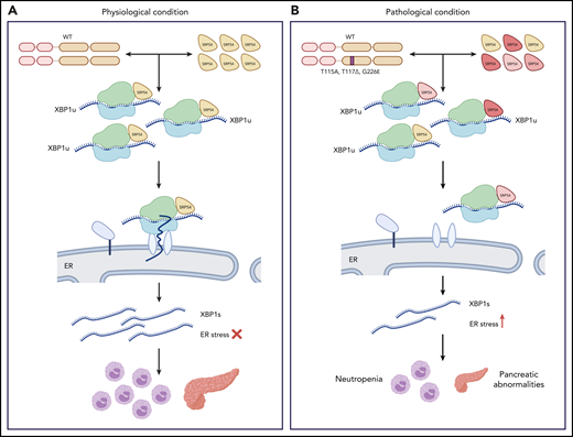 Impaired XBP1 splicing downstream of SRP54 mutations. During physiological conditions (A), the signal recognition particle 54 (SRP54) facilitates the translocation of the ribosome-associated unspliced XBP1 (XBP1u) to the ER where it is spliced (XBP1s). In pathological conditions (B), SRP54 mutations found in patients act in a dominant-negative manner to wild-type (WT) SRP54 and impair XBP1 splicing, leading to neutropenia and decreased size of the exocrine pancreas. Image by Veronica Bergo, created with BioRender.com.