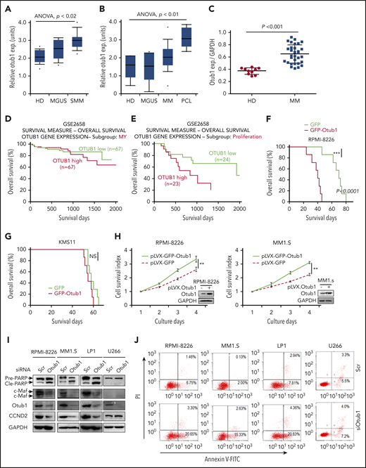 Otub1 is overexpressed in MM and confers poor prognosis to patients with MM. (A) Otub1 cDNA expression (exp.) was analyzed from HDs (n = 23), monoclonal gammopathy of undetermined significance (MGUS) (n = 44), and smoldering MM (SMM) (n = 12) based on the Zhan Myeloma 3 data set.13 (B) Otub1 cDNA was analyzed from HD (n = 5), MGUS (n = 11), MM (n = 133), and plasma cell leukemia (PCL) (n = 9) based on the Agnelli Myeloma 3 data set.14 (C) qRT-PCR analysis of Otub1 in bone marrow cells from HDs (n = 10) and patients with MM (n = 30). (D-E) Otub1 expression and clinical outcomes were evaluated based on the GSE2658 GEP data set2 on the PROGgeneV2 platform.15 Otub1 predicted an inferior prognosis for patients with MM in the myloid (MY) (D) and the proliferation (E) subgroups. (F-G) RPMI-8226 (F) with high c-Maf and KMS11 (G) with low c-Maf were stably infected with lentiviral GFP or GFP-Otub1. Cells were injected into nude mice via the tail vein. Mice survival was then monitored. (H) RPMI-8226 and MM1.S cells were stably infected with lentiviral Otub1, followed by cell viability assay with MTT. (I-J) MM cells were transfected with siOtub1 for 48 hours, followed by IB (I) and apoptotic assays on a flow cytometer (J). **P < .01; ***P < .001. NS, not significant; Scr, scramble.