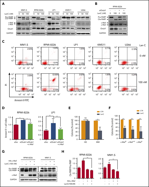 Inhibition of the Otub1/c-Maf axis by LanC induces MM cell apoptosis. (A) MM cells were incubated with LanC overnight, followed by IB assays. (B) RPMI-8226 cells were transfected with siOtub1 for 48 hours, followed by LanC treatment and IB assays. (C) MM cells were incubated with LanC overnight, followed by Annexin V/PI staining and flow cytometric analysis. (D) MM cells were transfected with siOtub1 alone or with c-Maf for 48 hours, followed by Annexin V-FITC staining and flow cytometric analysis (n = 3). (E) Bone marrow mononuclear cells from patients with MM (n = 23) or HDs (n = 5) were mixed in LanC (10 nM)–containing MethoCult medium and cultured in 3.5-cm dishes for 14 days before colony counts. (E) Based on the c-Maf measurement of qRT-PCR results, 23 patients with MM from panel D were divided into 3 groups (c-Maflow, c-Mafmid, and c-Mafhi); colonies were then statistically analyzed. (F) RPMI-8226 and MM1.S cells were transfected with c-Maf, followed by LanC treatment of 24 hours and IB assays. (G) The Cle-PARP/Pro-PARP ratios from panel F were quantified. *P < .05; **P < .01. NS, not significant.
