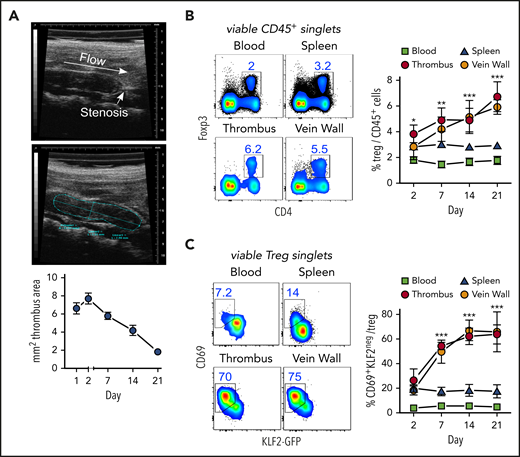 Activated, resident Tregs accumulate in venous blood clots. (A) Representative transversal ultrasound views of thrombi with ligature position marked and thrombus outlined for size determination; ultrasound data show the size progression of thrombi in C57BL/6 mice (n = 5 group/time point). (B) Treg frequencies in thrombi, adjacent venous walls, spleen, and blood during thrombus resolution. (C) Treg CD69- and KLF2-expression kinetics in KLF2GFP mice. Representative day 14 flow cytometric profiles; mean ± SEM values are shown (**P ≤ .005;***P ≤ .0005; ns, not significant; spleen/blood, n = 10; thrombus/vein, n = 5 group/time point). All statistical differences were tested using an unpaired Student t test (2 tailed). Profiles are representative of 3 independent experiments.