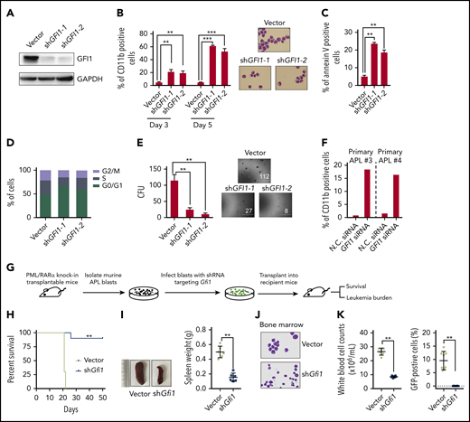 PML/RARα-activated GFI1 is necessary for the maintenance of APL. (A-E) Detailed shRNA-mediated loss-of-function analyses on PML/RARα-activated GFI1. Western blot was performed to validate the knockdown efficiency of shRNAs targeting GFI1 (A). Knockdown of GFI1 induced partial differentiation (B) and apoptosis (C), promoted the G0/G1 phase arrest (D), and decreased the colony-forming capacity (E). The expression of the cell surface differentiation marker CD11b in shGFI1 positively transfected cells was determined by flow cytometry and the morphology was detected by Wright-Giemsa staining. Apoptosis was detected in NB4 cells after transfection of shRNA constructs for 4 days and determined by Annexin V-APC staining. Data represent the mean of 3 replicates ± SD. **P < .001, ***P < .0001. (F) GFI1 function was verified in primary APL blast cells. GFI1 siRNAs or negative control (N.C.) were transfected into blast cells isolated from 2 primary APL patients. (G) The schematic diagram of the in vivo experiment. Murine APL blasts isolated from transplantable APL mice were transduced with the shRNA targeting Gfi1, and then the shRNA-positive cells with ZsGreen1 expression were sorted and transplanted into the recipient FVB/NJ mice. The shRNA empty vector was used as the control. (H) Altered disease onset of APL after Gfi1 knockdown. PML/RARα-positive leukemia cells separated from APL transplantable mice (n = 6) were transduced with shRNA targeting Gfi1 or vector and then transplanted into recipient mice. The statistical significance was calculated by the log-rank (Mantel-Cox) test. **P < .001. (I) Knockdown of Gfi1 in murine APL cells resulted in no obvious splenomegaly in APL transplantable mice. Left panels show the representative images of the spleen. **P < .001. (J) Murine APL blasts were hardly seen in bone marrow of mice upon Gfi1 knockdown, as shown by representative Wright-Giemsa staining of bone marrow smears. (K) The tumor burden in the peripheral blood of mice transplanted with PML/RARα-positive cells with GFI1 knockdown, as compared with those transplanted with cells without GFI1 knockdown. The left panel shows the total white blood cell counts, and the percentage of GFP-positive abnormal promyelocytes is shown in the right panel. **P < .001.