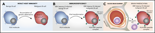 Pathogenesis of EBV tissue-positive PCNSL in the immunosuppressed, and potential implications for immunotherapy. (A) Mutations in the NF-κB and cell-cycling pathways and deletion of HLA class I/II molecules in EBV− HIV− PCNSL. (B) Viral transformation in EBV tissue-positive PCNSL, with the loss of host immunity providing no selection pressure to prevent presentation of EBV-immunogenic peptides by HLA I/II molecules. (C) EBV-specific viral specific T cells (VST) cross the blood–brain barrier to target the EBV+ malignant B cell.
