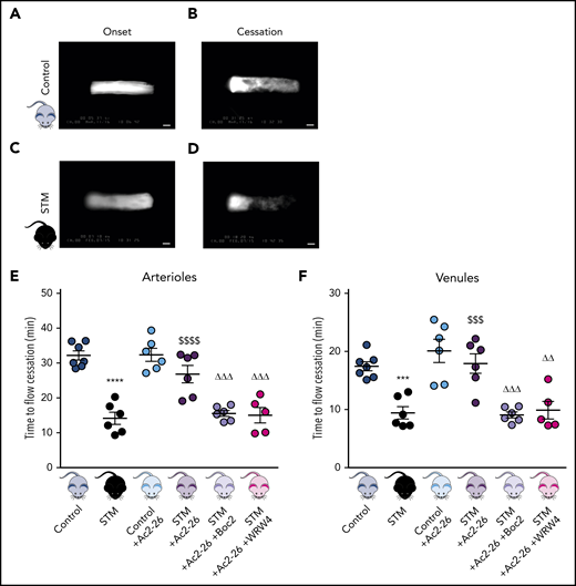AnxA1Ac2-26 rescues enhanced cerebral thrombus formation. STM and control mice were subjected to light/dye-induced thrombosis with intravenous infusion of 10 mg/kg 5% FITC-dextran followed by photoactivation of cerebral microvessels. (A-D) Images of onset (start of platelet aggregation) and cessation (complete stop of flow for ≥30 seconds) of thrombus formation in control mice and STM. Bars represent 20 μm. The mice were treated with vehicle (saline), AnxA1Ac2-26 (100 μg per mouse), AnxA1Ac2-26+Boc2 (100 μg per mouse + 10 μg per mouse), or AnxA1Ac2-26+WRW4 (100 μg per mouse + 55 μg per mouse), and subjected to light/dye-induced thrombosis, and time of flow cessation (minutes) was quantified in cerebral (E) arterioles and (F) venules. Data are means ± SEM (6-7 mice per group). ***P < .001; ****P < .0001 vs controls. $$$P < .001; $ $ $ $P < .0001 vs STM controls. ΔΔP < .01; ΔΔΔP < .001 vs STM+AnxA1Ac2-26–treated mice.