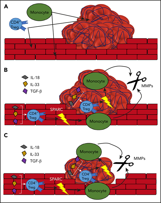 The proposed model of Treg-dependent thrombolysis by monocytes. (A) The formation of a thrombus in the blood vessel attracts monocytes and Tregs. (B) The Tregs express SPARC in an IL-18, IL-33, and TGF-β–dependent manner. SPARC stimulates the release of MMPs from the monocytes. (C) The MMPs degrade the thrombus and thus help with its removal.