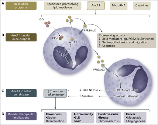 Role of AnxA1 in the resolution of neutrophil-dependent thromboinflammation in SCD and beyond. (A) Proresolving factors comprise lipid mediators, nucleic acids, and proteins, including cytokines and AnxA1. (B) AnxA1 is a glucocorticoid (GC)-regulated protein that mediates some of the anti-inflammatory effects of endogenous and synthetic GCs via its main receptor, FPR2/ALX. (C) In SCD, AnxA1 may act in neutrophils to downregulate the activity of ERK and Akt signaling pathways and promote cleavage of caspase 3, resulting in a switch from a proneutrophil extracellular trap (NET)-otic to apoptotic phenotype, thus reducing thromboinflammation. (D) Neutrophil reprogramming via AnxA1 and its related peptides may have therapeutic potential in a broad range of diseases where NETosis contributes to pathogenesis.