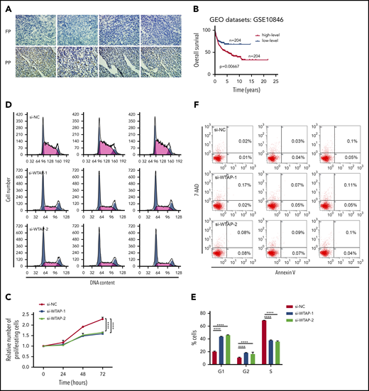 WTAP is a functionally important target gene of piRNA-30473 in DLBCL. (A) Representative immunohistochemical staining (original magnification ×40) of WTAP in DLBCL patients is shown. WTAP-positive particles (brown) are apparent in the nucleus (nuclei stained with hematoxylin, blue). Original magnification ×40. (B) OS was plotted and compared using the Kaplan-Meier method and log-rank test. WTAP was dichotomized at the median based on low vs high expression. (C) SU-DHL-8 cells (si-NC or si-WTAP-transfected) were harvested at 24, 48, and 72 hours after transfection. Cell proliferation was assessed by CCK-8 assays. (D-E) Cell cycle distribution of control and WTAP-depleted SU-DHL-8 cells examined by DNA content index at 48 hours after transfection. (F) The percentage of apoptotic cells in control and WTAP-depleted SU-DHL-8 cells was examined at 48 hours after transfection. Error bars represent the mean ± SD of 3 independent experiments. ****P < .0001.