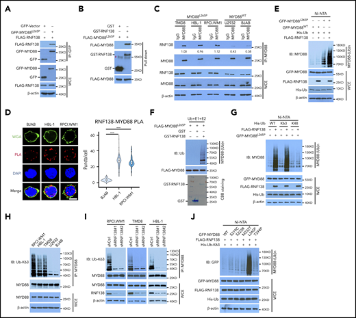 RNF138 interacts with MYD88L265P and promotes MYD88L265P ubiquitination. (A) Co-IP analysis of MYD88L265P and RNF138 interaction in 293T cells transfected with the indicated constructs. (B) Direct binding between RNF138 and MYD88L265P. FLAG-MYD88L265P immunoprecipitated from 293T cells bound to GST-RNF138 in vitro. #, non-specific signal. (C) Co-IP analysis of the endogenous MYD88 and RNF138 interaction in lymphoma cells. (D) PLA of MYD88 and RNF138 interaction in lymphoma cells. ***P < .001. The bar represents 5 μm. Wheat germ agglutinin (WGA), Alexa Fluor 488 (green); PLA, Alexa Fluor 568 (red). (E) In vivo MYD88L265P and MYD88WT ubiquitination by RNF138 in 293T cells. His-Ub–linked proteins were purified using Ni-NTA beads from cell lysates before they were subjected to IB analysis with MYD88 antibody. (F) MYD88L265P ubiquitination by RNF138 in vitro. FLAG-MYD88L265P was incubated with E1, E2, and ubiquitin+GST or GST-RNF138 in a cell-free system. CBB Coomassie brilliant blue. (G) RNF138-mediated MYD88L265P ubiquitination with ubiquitin mutants in 293T cells. Cells were transfected with RNF138 and MYD88L265P, along with WT or mutant ubiquitin and subjected to Ni-NTA bead purification and IB analysis as in panel E. (H) Endogenous MYD88 ubiquitination in MYD88L265P (RPCI.WM1, HBL-1, and TMD8 cells) and MYD88WT (U2932 and BJAB) cell lines. Lysates from cells were immunoprecipitated using the antibody against MYD88 before they were subjected to IB with Ub-K63 antibody. (I) Endogenous MYD88L265P ubiquitination in RPCI.WM1, TMD8, and HBL-1 cells with RNF138 knockdown. Lysates from control and RNF138 stable knockdown cells were immunoprecipitated using the antibody against MYD88 before they were subjected to IB. (J) RNF138-mediated ubiquitination on MYD88 mutants in 293T cells. His-Ub–linked proteins were purified using Ni-NTA beads from cell lysates before IB analysis with GFP antibody. WCE, whole-cell extract.