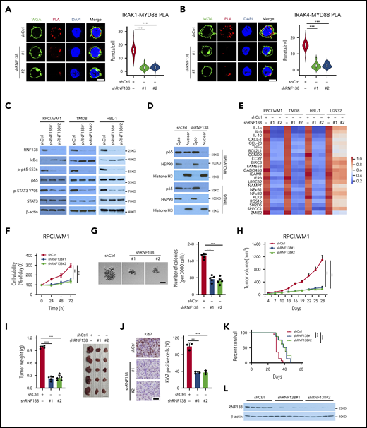 RNF138 is required for NF-κB activation and tumor growth in MYD88L265P lymphoma cells. (A-B) PLA to analyze the interaction between MYD88L265P and IRAK-1 (A) or IRAK-4 (B) in TMD8 cells with RNF138 knockdown. ***P < .001. The bars represent 5 μm. WGA, Alexa Fluor 488 (green); PLA, Alexa Fluor 568 (red). (C) IB analysis of NF-κB and STAT3 signaling in RPCI.WM1, TMD8, and HBL-1 cells with RNF138 knockdown. (D) IB analysis of p65 in cytosolic (cyto) and nuclear fractions from RPCI.WM1 and TMD8 cells with RNF138 knockdown. (E) Real-time polymerase chain reaction analysis of NF-κB downstream target genes in RPCI.WM1, TMD8, HBL-1, and U2932 cells after RNF138 knockdown. (F-G) MTS (F) and colony-forming unit (G) assays to examine cell viability and colony formation of RPCI.WM1 cell. ***P < .001. The bar represents 50 μm. (H-J) Effect of RNF138 knockdown on tumor growth of RPCI.WM1 cells in NSG mice. Tumor volumes were monitored (H), and tumors were dissected and weighed (I). The bar represents 1 cm. (J) Ki67 was examined using IHC analysis. Ki67 was stained with DAB as the chromogen (brown). The bar represents 25 μm. ***P < .001. (K) Kaplan-Meier curve analysis of the survival of mice bearing RPCI.WM1 xenograft tumors. ***P < .001. (L) IB analysis of RNF138 protein levels in individual RPCI.WM1-derived xenograft tumors. WCE, whole-cell extract.