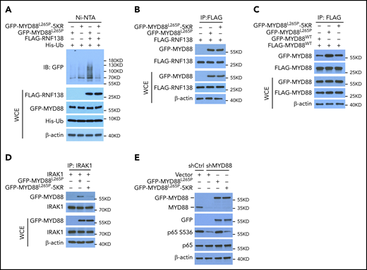 K63-linked polyubiquitination of MYD88L265P is critical for NF-κB activation. (A) MYD88L265P and MYD88L265P-5KR ubiquitination by RNF138 in 293T cells. Ubiquitination was analyzed as in Figure 1E. (B) Co-IP analysis of the interaction between RNF138 and MYD88L265P or MYD88L265P-5KR in 293T cells. (C) Co-IP analysis of the interaction between FLAG-MYD88WT and GFP-tagged MYD88WT, MYD88L265P, or MYD88L265P-5KR in 293T cells. Equimolar amounts of MYD88 constructs were introduced into the cells. (D) Co-IP analysis of the interaction between IRAK-1 and MYD88L265P or MYD88L265P-5KR in 293T cells. (E) IB analysis of p65 phosphorylation in RPCI.WM1 cells with MYD88 knockdown and reintroduction of MYD88L265P or MYD88L265P-5KR. WCE, whole-cell extract.