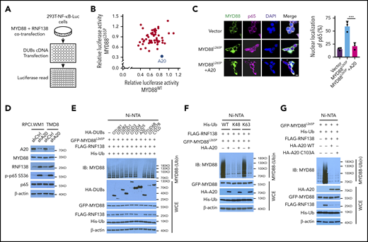 A20 inhibits MYD88L265P K63-linked polyubiquitination and abrogates NF-κB activation. (A) Schematic workflow of DUB screening assay using 293T-NF-κB-Luc cells. (B) Effect of DUB on NF-κB luciferase activity in 293T-NF-κB-Luc cells. Cells were transfected with vector control or cotransfected MYD88L265P /MYD88WT, RNF138, and DUBs and examined for luciferase activity. Blue spot, A20; gray spot, vector control. (C) Effect of A20 on MYD88L265P-mediated p65 nuclear localization in 293T cells. Cells were transfected with MYD88L265P and A20 and analyzed by IF. ***P < .001. The bar represents 10 μm. MYD88, Alexa Fluor 488 (green); p65, Alexa Fluor 647 (red). (D) The effect of A20 knockdown on p65 phosphorylation and RNF138 level in RPCI.WM1 and TMD8 cells. (E) Effect of DUBs on RNF138-mediated MYD88L265P ubiquitination in 293T cells. (F) Effect of A20 and Ub mutants on MYD88L265P ubiquitination in 293T cells. (G) Effect of A20 deubiquitination activity on MYD88L265P ubiquitination in 293T cells. Cells were transfected with GFP-MYD88L265P, FLAG-RNF138, and His-Ub, along with HA-A20 or HA-A20 C103A. The ubiquitination in panels A-G was analyzed as in Figure 1E. WCE, whole-cell extract.