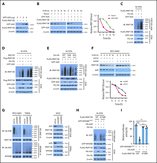 A20 mediates RNF138 degradation through K48-linked ubiquitination. (A) Effect of A20 on RNF138 protein levels in 293T cells. (B) The half-life of RNF138 in the presence of A20. FLAG-RNF138 and GFP-A20 were cotransfected into 293T cells and treated with cycloheximide (CHX). FLAG-RNF138 and GFP-A20 protein levels were analyzed by IB, quantified by densitometry, and plotted against treatment time. (C) Effect of A20 on RNF138 polyubiquitination in 293T cells. (D) A20-mediated RNF138 polyubiquitination in the presence of MG132. 293T cells were transfected with various constructs and treated with MG132 (20 μM) for 6 hours. (E) The types of polyubiquitination chains on RNF138 in 293T cells. (F) The half-life of RNF138 with A20 knockdown in RPCI.WM1 cells. Cells were transfected with shCtrl or shA20 and treated with CHX. Endogenous RNF138 protein levels were analyzed by IB, quantified by densitometry, and plotted against treatment time. (G) Endogenous RNF138 and MYD88L265P ubiquitination in RPCI.WM1 and TMD8 cells after A20 knockdown. (H) Effect of A20 and RNF138 K158R on MYD88L265P ubiquitination in 293T cells. In panels C, D, E, and H, His-Ub-linked proteins were purified by using Ni-NTA beads from cell lysates before they were subjected to IB with RNF138 antibody. (I) Effect of RNF138 K158R and A20 on NF-κB reporter activity mediated by MYD88L265P in 293T-NF-κB-Luc cells. ***P < .001. WCE, whole-cell extract.