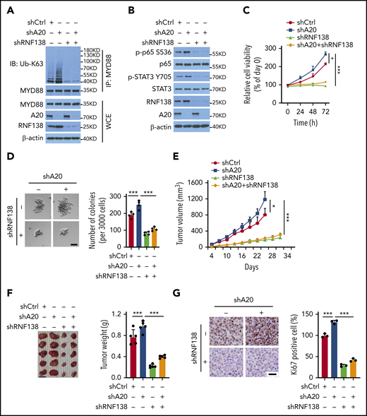 A20-mediated degradation of RNF138 restricts MYD88L265P oncogenic activity. (A-B) Effects of A20 depletion on RNF138 expression and MYD88L265P ubiquitination (A) and downstream signaling (B) in RPCI.WM1 cells. (C-D) Effects of A20 and/or RNF138 depletion in cell viability and colony formation. RPCI.WM1 cells were transfected with shRNAs targeting A20, RNF138, or both, before subjected to MTS (C) and CFU (D) assays. The bar represents 50 μm. ***P < .001. (E-G) Tumorigenesis of RPCI.WM1 cells with A20 and/or RNF138 knockdown. Cells were transfected with shRNAs targeting A20, RNF138, or both, and injected into NSG mice. The tumors were analyzed as described in panels H-J of Figure 2. Ki67 was stained with DAB as the chromogen (brown) (G). The bar in panel F represents 1 cm; panel G, 25 μm. *P < .05, ***P < .001. WCE, whole-cell extract.