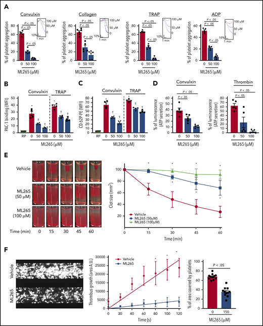 ML265 treatment regulates dimeric PKM2 formation to inhibit multiple aspects of human platelet functions. (A) Human platelet-rich plasma pretreated with vehicle or ML265 and stimulated with convulxin (5 ng/mL), collagen (2.5 μg), TRAP (10 μM), and ADP (5 μM). Results are expressed as the percent change in light transmission with respect to the blank (platelet-poor plasma/buffer without platelets), set at 100%. The upper panel in each bar graph denotes the representative aggregation curves (blue, vehicle-control; black, 50 μM ML265; red, 100 μM ML265). Values are mean ± SEM, n = 5 individual donors per group. One-way ANOVA followed by Tukey’s multiple comparisons test. Effect of dimeric PKM2 inhibition on integrin αIIbβ3 activation (B), P-selectin exposure (C), and ATP secretion (D) from dense granules in stimulated-platelets with convulxin (5 ng/mL), TRAP (50 μM), and thrombin (0.1 U/mL). Values are mean ± SEM, n = 4 to 5 individual donors per group. *P < .05 vs resting platelets, †P < .05 vs vehicle. Two-way ANOVA (B and C) and one-way ANOVA (D) with Tukey’s multiple comparisons test. (E) Clot retraction was measured for 1 hour in platelet-rich plasma, supplemented with red blood cells, after adding 0.25 U/mL of thrombin in the presence of a vehicle or ML265 (50 and 100 μM). The left panels show representative images at different time points; the right panel shows the quantification of clot size with time. Values are mean ± SEM, n = 4 individual donors per group. Two-way ANOVA with Tukey’s multiple comparisons test. (F) Human whole blood pretreated with vehicle or ML265 (150 μM) was perfused over a collagen-coated (100 μg/mL) surface for 5 minutes at a shear rate of 1500 s−1 in a BioFlux Microfluidic flow chamber system from Fluxion Biosciences. The left panel shows the representative image at the end of the assay. The middle panel shows the thrombus growth on the collagen matrix over time. Slopes over time showed that the rate of thrombus growth in ML265-treated whole blood (slope, 37.92) was decreased compared with vehicle control (slope, 237.3). Values are mean ± SEM, n = 3 individual donors per group. *P < .05. Two-way ANOVA with Tukey’s multiple comparisons test. The right panel shows the surface area covered by fluorescent platelets after 5 minutes of perfusion. Three to 4 areas from different areas of the flow chamber were analyzed from each blood sample. Values are mean ± SEM, n = 11 areas per group; Mann-Whitney U test. MFI, mean fluorescence intensity; PE, phycoerythrin.