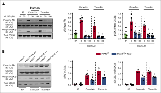 PKM2 regulates PI3K-mediated Akt/GSK3β signaling in platelets. (A) Human and mouse platelets were pretreated with vehicle or ML265 (50 and 100 μM) for 10 minutes at room temperature before stimulation with convulxin (100 ng/mL) or thrombin (0.1 U/ml) for 10 minutes. The left panels show representative western blots for phospho-Akt (Ser 473), total Akt, phospho-GSK3β, and total GSK3β. The middle and right panels show densitometry analysis of immunoblots. Values are mean ± SEM, n = 4 per group. *P < .05 vs resting platelets, †P < .05 vs activated platelets (vehicle). Two-way ANOVA with Tukey’s multiple comparisons test. (B) Platelets from PKM2fl/fl or PKM2fl/flPF4Cre+ were stimulated with convulxin (100 ng/mL) or thrombin (0.1 U/mL) for 10 minutes. The left panels show representative western blots for phospho-Akt (Ser 473), total Akt, phospho-GSK3β, and total GSK3β; the middle and right panels show densitometry analysis of immunoblots. Values are mean ± SEM, n = 3 to 4 per group. *P < .05 vs resting platelets, †P < .05 vs PKM2fl/fl. Two-way ANOVA with Tukey’s multiple comparisons test. RP, resting platelets.