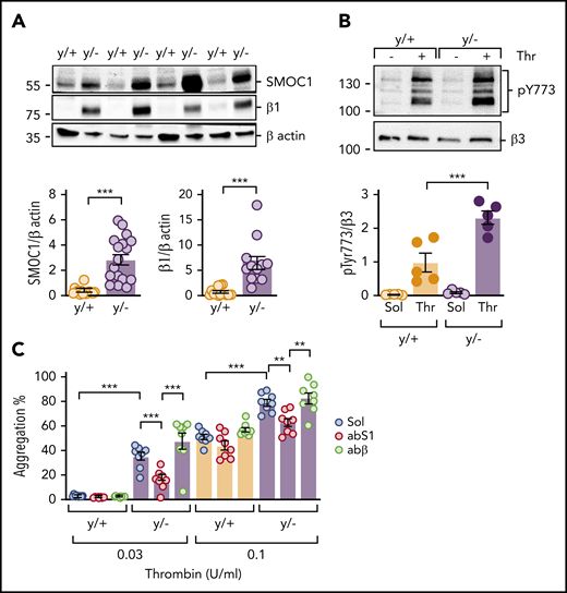 Consequences of miR-223 knockout on platelet SMOC1 expression and responsiveness to thrombin. (A) SMOC1 and β1-integrin (β1) levels in washed platelets from WT (y/+) and miR-223y/− (y/−) mice; n = 14 per group. ***P < .001, Student t test. (B) Thrombin (Thr; 1 U/mL; 10 minutes)–induced phosphorylation of β3-integrin on Tyr773 (pY773) in platelets from WT (y/+) and miR-223y/− (y/−) mice; n = 5 per group. ***P < .001, ANOVA and Bonferroni test. (C) Thrombin-induced aggregation in platelets from WT (y/+) and miR-223y/− (y/−) mice in the presence of solvent (Sol), an antibody against SMOC1 (abS1; 0.625 ng/µL), or an anti–β-actin antibody (abβ; 0.625 ng/µL); n = 8 animals per group. **P < .01, ***P < .001, 2-way ANOVA and Bonferroni test.