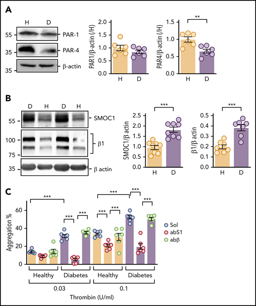 SMOC1 expression in platelets from healthy donors and subjects with type 2 diabetes. Washed platelets were isolated from nondiabetic subjects (healthy; H) and individuals with type 2 diabetes (D). (A) PAR1 and PAR4 expression; n = 6 per group, **P < .01, Student t test. (B) SMOC1 and β1-integrin (β1) levels; n = 8 per group. ***P < .001, Student t test. (C) Thrombin-induced platelet aggregation in the presence of solvent (Sol), an antibody against SMOC1 (abS1), or an anti–β-actin antibody (abβ); n = 6 subjects per group. ***P < .001, 2-way ANOVA and Bonferroni test.