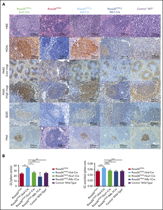Immunohistochemical analysis of spleens at day 10 after immunization with SRBCs. (A) Representative hematoxylin and eosin (H&E), HGAL, PAX5, B220, and PNA staining of serial sections of spleens from Rosa26HGAL/Aid-Cre, Rosa26HGAL/Sca1-Cre, Rosa26HGAL, Rosa26HGAL/Mb1-Cre, and WT mice. HGAL is strongly expressed in the GC lymphocytes of Rosa26HGAL/Aid-Cre and Rosa26HGAL/Sca1-Cre animals, with weaker expression in Rosa26HGAL/Mb1-Cre animals because of the smaller size of GCs. (B) Quantification of the number (left panel) and area (right panel) of PNA-stained GC centers in Rosa26HGAL/Aid-Cre, Rosa26HGAL/Sca1-Cre, Rosa26HGAL, Rosa26HGAL/Mb1-Cre, and wild type-mice (n = 6 each). Data are mean ± standard deviation. *P < .05; **P < .01; ***P < .001, Bonferroni multiple-comparison test (1-way analysis of variance).