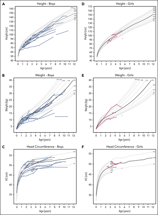 Height, weight, and head circumference of the patients. Each line represents a patient, and each circle indicates an individual measurement. The gray lines show the standard growth curves for the 3rd, 5th, 10th, 25th, 50th, 75th, 90th, 95th, and 99th percentiles.18 In the graphs on the left (A-C), blue lines indicate boys, and in the graphs on the right (D-F), red lines indicate the girls.