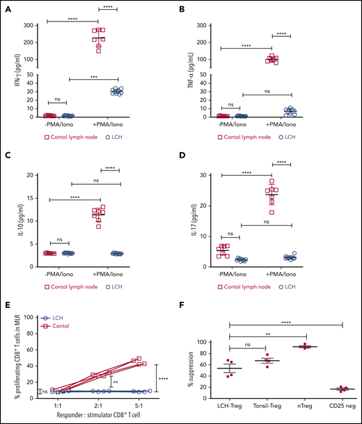 Infiltrating T lymphocytes in the LCH tumor microenvironment are dysfunctional. (A-D) Relative expression of the indicated cytokines in CD8+ T cells isolated from LCH lesions (n = 10) and control lymph nodes from a tonsillectomy (n = 7) before and after activation with PMA and ionomycin (PMA/Iono). Data are means ± SD. (E) CD8+ T cells isolated from LCH lesions, but not PBMCs from healthy donors (control), were dysfunctional, as determined by mixed lymphocyte reaction (MLR) assay. Data points represent averaged triplicate measures from cells isolated from 4 patients with LCH or controls. (F) The inhibitory activity of Tregs isolated from LCH lesions or freshly isolated “natural” Tregs (nTregs; CD3+CD4+CD25Bright), which develop in the thymus during the course of positive and negative selection, Tregs isolated from tonsils obtained from a tonsillectomy, and CD25Dep (CD3+CD4+CD25Low) cells (n = 4 each) were assessed in a CFSE-based suppression assay. Data are the mean ± SD. **P < .01; ***P < .001; ****P < .0001, ns, not significant (P > .05), by 1-way ANOVA with Tukey’s post hoc test.