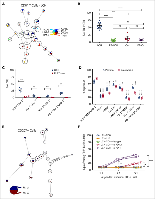 Infiltrating T lymphocytes in the LCH tumor microenvironment exhibit an exhausted phenotype. (A) Expression of different immune checkpoint receptors on LCH lesion-infiltrating CD8+ T cells. Analyses of CyTOF data were performed using the FlowSOM algorithm and visualized as pie charts. (B-C) Quantification of relative expression of PD-1 (n = 15, LCH; n = 10, control) (B) and coexpression of immune checkpoint receptors (n = 5 each) (C) in CD8+ T cells, as determined by CyTOF. Data are the means ± SD. (D) Relative expression of perforin and granzyme B in LCH lesion–infiltrating CD8+ T cells not expressing PD-1, TIM-3, or LAG-3 or expressing 1 or more of the immune checkpoint receptors (n = 5). Data are the mean ± SD. (E) Pie chart representing FlowSOM algorithm–based assessment of PD-L1 and PD-L2 expression on CD207+ gated cells. (F) Effector function of CD8+ T cells was restored after treatment for 24 hours with anti-PD-1 but not with anti-PD-L1 antibody, as determined by mixed lymphocyte reaction (MLR) assay. Data points represent averaged triplicate measures from cells isolated from 4 patients with LCH. For all panels, LCH lesions were derived from liver, bone, or spleen. *P < .05, **P < .01, ***P < .001, ****P < .0001, ns, not significant (P > .05), by 1-way ANOVA with Tukey’s post hoc test.
