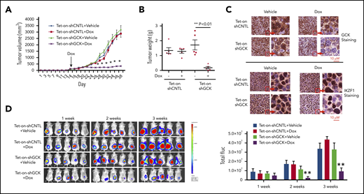 Inhibition of GCK in MM cells abrogates tumor growth in vivo. Tet-on-shCNTL-MM.1S or Tet-On-shGCK-MM.1S cells were injected subcutaneously into SCID/bg mice. Sixteen days after implantation, all mice developed a subcutaneous tumor and were randomized to receive either vehicle (5% sucrose) or Dox (1 mg/mL in 5% sucrose) via drinking water for the duration of study. (A) Subcutaneous tumor growth was measured by using calipers and calculated with the volume formula: 0.5 × long diameter × short diameter.2 Each bar represents the mean ± standard error of the mean (SEM; n = 5). **Indicates significance with P < .01. (B) Mice were euthanized after 38 days. Tumors were excised and weighed. Tumor weights are reported as mean ± SEM (n = 5). **Indicates significance with P < .01. (C) Tumors harvested at the end of the study were fixed in 10% formalin and subsequently processed for immunohistochemical staining for GCK and IKZF1. The slides were scanned using a high-resolution scanner (Leica SCN400 Slide Scanner) at ×40 magnification. (D) SCID/bg mice were injected with Tet-On-shCNTL-MM.1S or Tet-On-shGCK-MM.1S cells expressing luciferase (n = 5). After 1, 2, and 3 weeks, mice received intraperitoneal (3 mg/mouse) d-luciferin 10 minutes before BLI. Bioluminescent signal and grayscale photographic images were acquired using the IVIS Spectrum Bioluminescence and Fluorescence Optical Imaging System and Living Image software.