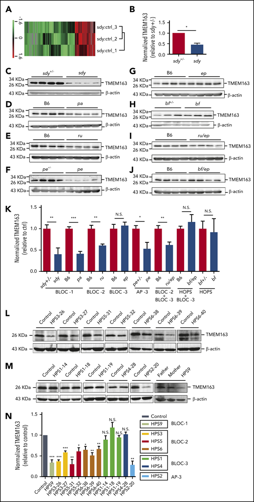 TMEM163 is reduced in platelets from HPS mouse models and patients with deficiency of BLOC-1, BLOC-2, or AP-3, but not BLOC-3. (A-B) Quantitative protein identification using liquid chromatography-mass spectrometery (LC-MS) of whole-platelet lysates in sdy mice compared with sdy+/− mice (ctrl). A total of 195 proteins (listed in supplemental Table 1) were selected using the Student t test and quantified with high confidence (P < .05). Hierarchy clustering of the z-scored isobaric tag for relative and absolute quantitation (iTRAQ) ratio of sdy to sdy+/− was used to evaluate the reproducibility of the experiments (A). The expression of TMEM163 in the platelets of sdy mice showed significant reduction compared with sdy+/− mice (B). n = 3, *P < .05. (C-J) Immunoblotting analysis of TMEM163 in platelets isolated from control mice and congenic HPS mutant mouse platelets with antibodies to TMEM163 or actin (a loading control). The expression of TMEM163 in platelets of sdy (BLOC-1-deficient HPS7 mutant), pa (BLOC-1-deficient HPS9 mutant), ru (BLOC-2-deficient HPS6 mutant), pe (AP-3-deficient HPS2 mutant), and ru/ep (BLOC-3-deficient model) double-mutant mice (both BLOC-2 and BLOC-3-deficient model) are significantly reduced compared with control mice (C-F,I). The expression of TMEM163 in platelets of ep, bf (the VPS33AD251E mutation model), and bf/ep showed no significant change compared with control mice (G-H,J). (K) TMEM163 band intensities were measured from ≥4 pairs of mice, normalized to actin levels, and expressed as the percentage (mean ± SEM) of the mean normalized value for control mice. (L) Immunoblotting assays showed the reduced TMEM163 in BLOC-2–deficient patients (2 HPS3, 2 HPS5, and 3 HPS6) compared with the healthy control (father or mother of each patient). (M) Immunoblotting assays showed normal TMEM163 in BLOC-3–deficient patients (3 HPS1 and 1 HPS4) and reduced TMEM163 in an AP-3–deficient patient (1 HPS2) and BLOC-1 deficient patient (1 HPS9) compared with the healthy control (father or mother of each patient). (N) Quantitative analysis of the TMEM163 band intensities. Each bar represents the percentage (mean ± SEM) of the mean normalized value for healthy control from 3 independent experiments. *P < .05; **P < .01; ***P < .001. ctrl, control; N.S., not significant.