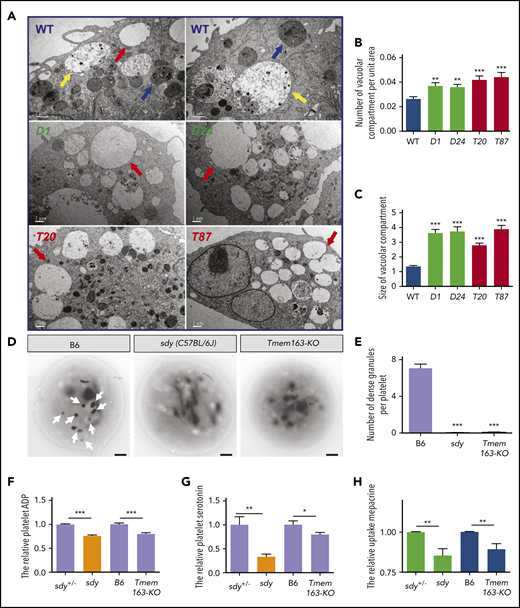 Ultrastructures of DGs in MEG-01 cells and platelets with deficiencies in dysbindin or TMEM163. (A) Thin-section TEM pictures of DTNBP1-KO (D1 and D24) and TMEM163-KO (T20 and T87) MEG-01 cells after induction with 100 nM TPA for 4 days. Red arrows represent round membranous organelles resembling EEs with reduced intraluminal contents, yellow arrows represent round membranous organelles resembling LEs with increased intraluminal contents, and blue arrows represent MVB circular membranous organelles. Scale bars, 1 µm. (B) The average number of vacuolar compartment (red arrows shown in panel A) per unit area (µm2) in DTNBP1-KO (D1 and D24) and TMEM163-KO (T20 and T87) MEG-01 cells are significantly higher than that in control (WT) cells (WT, 0.027 ± 0.002, n = 47; D1, 0.037 ± 0.003, n = 48; D24, 0.036 ± 0.002, n = 52; T20, 0.042 ± 0.003, n = 55; T87, 0.044 ± 0.004, n = 40). (C) The average size of the vacuolar compartment (µm2) in DTNBP1-KO (D1 and D24) and TMEM163-KO (T20 and T87) MEG-01 cells is significantly larger than that in WT cells (WT, 1.343 ± 0.080, n = 158; D1, 3.637 ± 0.234, n = 299; D24, 3.736 ± 0.302, n = 273; T20, 2.791 ± 0.145, n = 382; T87, 3.890 ± 0.245, n = 304). (D-E) TEM pictures of whole-mount platelets of the B6 (WT, C57BL/6J), sdy mutant, and Tmem163-KO mice. Arrows show platelet DGs. Lighter-intensity dots or smaller dots (diameter <100 nm) are not counted as DGs. Scale bars, 0.5 μm. DGs are absent in sdy (0.029 ± 0.020, n = 69) and Tmem163-KO (0.095 ± 0.020, n = 222) mice compared with B6 (7.069 ± 0.451, n = 58). (F-G) Washed platelets were lysed by 100 µL ice-cold lysis buffer, and the lysates used for further enzyme-linked immunosorbent assay were analyzed spectrophotometrically at 450 nm. The content of platelet ADP (sdy vs Tmem163-KO, 75.71% vs 79.77%, n = 4, 13, respectively) (F) and serotonin (sdy vs Tmem163-KO, 33.01% vs 79.51%, n = 6, 10, respectively) (G) of sdy, Tmem163-KO mice were calculated and plotted relative to their control littermates (sdy+/− or B6). (H) Platelets were incubated with 1.7 μM mepacrine at 37°C for 30 minutes and then analyzed by flow cytometry. The mepacrine uptake (green) fluorescence of sdy and Tmem163-KO was expressed as the percentage (mean ± SEM) of the mean normalized value for control mice (sdy vs Tmeme163-KO, 85.41% vs 89.29%, n = 9, 8, respectively). *P < .05; **P < .01; ***P < .001.