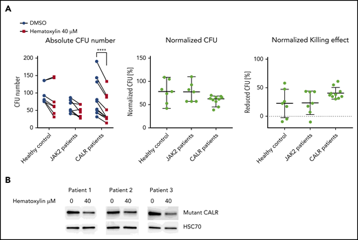 Hematoxylin inhibited the colony-forming capacity of CALR patient–derived CD34+ cells. (A) The colony formation assay of healthy individuals and JAK2V617F and CALR patients after hematoxylin treatment. CD34+ cells from 7 healthy controls, 7 JAK2 patients, and 10 CALR patients were isolated and plated for 10 to 14 days with DMSO or 40 μM of hematoxylin treatment before colony counting. Two-way analysis of variance followed by Sidak’s multiple comparisons test was used for P value calculation. Absolute colony count (left). Colony number of hematoxylin-treated plates normalized to the DMSO control plates from the same individual (middle). Reduced colony number of hematoxylin-treated plates normalized to the DMSO control plates from the same individual (bottom). (B) Western blot detecting mutant CALR protein extracted from CD34+ cells from 2 CALR del52/WT patients and 1 CALR ins5/WT patient with or without hematoxylin treatment. CD34+ cells were treated with DMSO or 40 μM of hematoxylin in StemSpan SFEM II with CD34+ expansion supplement for 16 hours before collection and protein extraction. ****P < .0001.