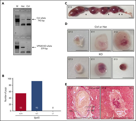 VPS45 is essential for mouse embryogenesis at an early stage. (A) Representative polymerase chain reaction–based genotyping results of postnatal progeny derived from Vps45 heterozygous intercrosses. Primer sets 1 and 2 used to identify control and heterozygous (Het) mice are shown in supplemental Figure 5A. M, DNA marker. (B) Genotyping results of 148 postnatal pups derived from Vps45 heterozygous intercrosses. (C) A representative uterus derived from heterozygous intercrosses dissected at E13. Arrowheads show smaller implantation sites, indicating embryos that either died or were severely delayed in development. Scale bar, 5 mm. (D) Representative pictures of excised embryos derived from Vps45 heterozygous intercrosses at E13, E11, and E7.5. Scale bars, 5 mm. (E) PAS-stained cross sections of paraffin-embedded E7.5 embryos derived from Vps45 heterozygous intercrosses showing the embryonic ectoderm (EE), endoderm (EN), and mesoderm (ME). Scale bars, 1 mm.