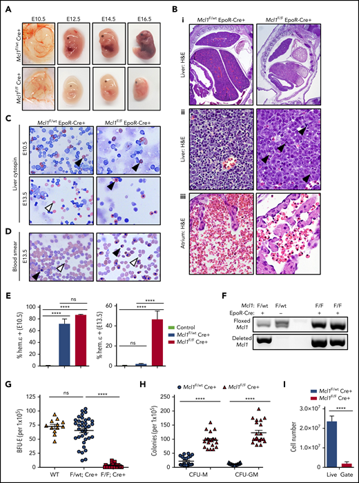 EpoR-Cre–mediated Mcl1 deletion leads to lethal failure of blood development. (A) Photographs of representative Mcl1F/F EpoR-Cre+ and Mcl1F/wt EpoR-Cre+ embryos at E10.5, E12.5, E14.5, and E16.5. (B) Representative images of hematoxylin and eosin (H&E)–stained sections from E12.5 embryos showing size and gross morphology of liver (original magnification ×2) (i), areas of apoptosis of liver (black arrowheads; original magnification ×60) (ii), and atrium of heart showing number and phenotype of RBCs (original magnification ×60) (iii). (C) Cytospin preparations from livers from E10.5 (upper panels) or E13.5 (lower panels) embryos (original magnification ×40, Wright-Giemsa stain). White arrowheads denote nonnucleated mature cells, and black arrowheads denote nucleated primitive cells. (D) Blood smears of whole blood from E13.5 embryos (original magnification ×40, Wright-Giemsa stain). White arrowheads denote nonnucleated mature cells, and black arrowheads denote nucleated primitive cells. (E) Intracellular staining of hemoglobin ε chain in E10.5 (left panel) or E13.5 (right panel) fetal livers. Control bar is isotype stain; n > 5 embryos per group. Bars represent mean ± standard error of the mean (SEM). ****P < .001, 1-way analysis of variance (ANOVA) with α = 0.05. (F) Genomic PCR for floxed or deleted allele of Mcl1 from E10.5 fetal liver cells. (G-H) Methylcellulose colony-forming assays were performed using total fetal liver cells and media as indicated; each point represents a plate (n > 12). Data are mean ± SEM. (G) Enumeration of BFU-Es grown on MethoCult GF M3434 (contains EPO). ****P < .001, 1-way ANOVA with α = 0.05. (H) Enumeration of granulocyte-macrophage progenitor cells (CFU-M and CFU-GM) grown on MethoCult GF M3534 (without EPO). ****P < .001, 1-way ANOVA with α = 0.05. (I) Enumeration of cells within the live gate by flow cytometry of fetal liver cells (n = 8-12 embryos from 4 litters). Data are mean ± SEM. ****P < .001, Student t test. ns, not significant; WT, wild-type.