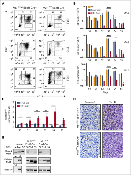 EpoR-Cre–mediated deletion of Mcl1 leads to blockade early in erythrocyte development. (A-C) Mouse fetal liver cells were isolated from Mcl1F/F EpoR-Cre+ or Mcl1F/wt EpoR-Cre+ embryos on the indicated day, labeled with CD45, CD71, TER119, or Annexin V antibodies, and analyzed by flow cytometry. (A) CD45− cells representing E11.5 (top panels), E13.5 (middle panels), and E15.5 (bottom panels) embryos. (B) Absolute cell numbers in each differentiation stage, as represented in (A). E11.5 (top panels), E13.5 (middle panels), and E15.5 (bottom panels) are shown (n ≥ 5 biological replicates with 4 embryos each). Data are mean ± standard error of the mean (SEM). **P < .1, ***P < .01, ****P < .001, 1-way analysis of variance with α = 0.05. (C) Annexin V+ (dead) cells in E13.5 Mcl1F/F EpoR-Cre+ or Mcl1F/wt EpoR-Cre+ fetal livers. Graph represents percentage relative to wild-type control (n > 13 embryos from 5 litters. *P < .5, **P < .01, ****P < .001, Student t test. Dashed line denotes fold change of 1. (D) Liver sections from representative embryos subjected to immunohistochemical staining for caspase-3 (left panels) and a glycophorin A–associated protein (TER119; right panel) (original magnification ×60). See "Materials and methods" for further details. (E) DNA from fetal liver cells isolated from Mcl1F/F EpoR-Cre+ or Mcl1F/wt EpoR-Cre+ embryos were analyzed by PCR. “Control” indicates PCR control and represents the expected banding pattern.