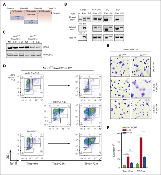 Ex vivo culture system allows temporally controlled deletion of Mcl1 from erythroid cultures. Fetal liver cells were isolated from E12.5 Mcl1F/F Rosa-ERCreT2+ or Mcl1F/wt Rosa-ERCreT2+ embryos; TER119− progenitor cells were purified using MACS MicroBeads and then cultured on fibronectin-coated plates. To induce Mcl1 deletion, fetal liver cells were treated with 4-OHT during the first 18 hours/overnight of culture (t = 0) or overnight the second day of culture (t = 24). Controls did not receive 4-OHT (No 4-OHT). (A) Diagram showing conditions and the time at which 4-OHT was added. (B) Cells were cultured as indicated and then harvested and analyzed by PCR. “Control” indicates PCR control and represents the expected banding pattern; No 4-OHT represents experimental control and represents nondeleted cells. (C) Immunoblot of MCL-1 levels in in vitro–differentiated cells treated with 4-OHT, as indicated. Ponceau S staining was used to indicate loading. (D) Representative flow cytometric analysis of CD45− in vitro–differentiated Mcl1F/F Rosa-ERCreT2+ fetal liver cells. (E) Cytospin preparations from Mcl1F/wt Rosa-ERCreT2+ or Mcl1F/F Rosa-ERCreT2+ fetal liver cells treated with 4-OHT overnight the second day of culture (original magnification ×40, Wright-Giemsa stain). (F) Cells were differentiated as indicated, harvested, and labeled with CD45, CD71, TER119, and Annexin V antibodies. Graph shows the percentage of Annexin V− (live) cells (n > 6 embryos from 2 biological replicates). Data are mean ± standard error of the mean. ****P < .001, 1-way analysis of variance, with α = 0.05. ns, not significant; NT, no treatment.