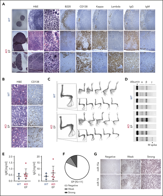 Characterization of PC neoplasm in KO mice. (A-B) Histologic and IHC stains of indicated markers on serial LN (A) and BM (B) sections from age-matched WT control and 2 representative KO mice with EP. Scale bars: white, 100 µm; black, 20 µm. (C) Bone radiographs of limbs with muscles still attached (top) or after removal (bottom) of WT and KO mice with PC neoplasm. One representative bone radiograph from each group is magnified to facilitate the interpretation. Note absence of bone lytic lesions in all EP cases. (D) Serum protein electrophoresis of WT and KO mice with PC neoplasm. Note presence of M spike in 1 of the EP cases. (E) Plasma IgM and IgG concentrations assessed using ELISA in WT and KO mice with PC neoplasm. Graphs depict the mean plus or minus SD. (F-G) miR-15a and miR-16 expression (ISH) assessed on FFPE biopsy sections from patients with EP (n = 11). (F) The ISH signal was scored into 3 grades ranging from negative, to weak, to strong in comparison with healthy nodal PCs. (G) A representative example for each grade is shown. Scale bar, 50 µm.