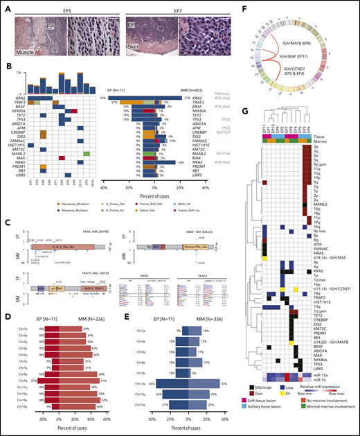 Mutational profiling of human primary EP. (A) Histologic H&E stains of 2 exemplary human primary EP included in the WES analysis. Note extramedullary localization of neoplastic PCs. Scale bar, 20 µm. (B) Oncoplot of mutations in 11 primary EP showing color-coded mutations in cancer candidate genes (right) and their frequency compared with MM (left). Number of nonsynonymous mutations for each sample is shown at the top. (C) Location of mutations in exemplary affected proteins in EP and MM. Colors represent mutation types as in panel B. Exemplary histograms from Sanger sequencing validating KRAS G12R and TRAF3 R505* mutations in EP8 and EP1, respectively, are shown. (D-E) Frequency of chromosomal arm-level gains (D) and losses (E) in EP in relation to MM. Note that del(13q) is the most common chromosomal alteration in EP and that frequency of chromosomal gains is lower in EP than in MM. (F) Circos plot of chromosomal rearrangements identified by fluorescence ISH. (G) Summary of genetic alterations identified in EP presented as color-coded matrix. Hierarchical clustering was done using 1 − the Pearson correlation. Expression of miR-15a and miR-16 determined using RT-qPCR relative to U6 is shown as heatmap at the bottom. SV, structural variation.