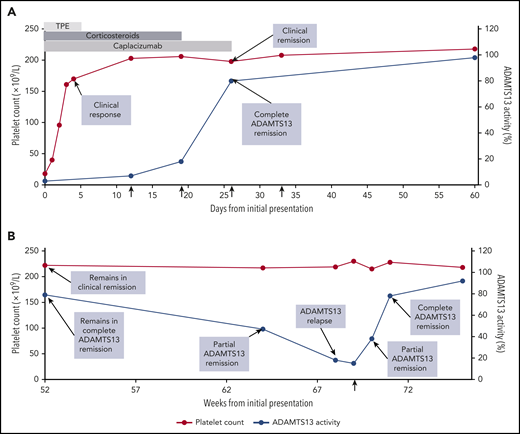 Clinical course of patient with iTTP. The clinical course of a 32-year-old woman with iTTP during the first 60 days (A) and at 1 year (B). She presented on day 0 with petechiae, abdominal pain, a platelet count of 18 × 109/L (normal range, 150 × 109/L to 400 × 109/L), a markedly elevated LDH, and schistocytes on the peripheral blood smear (A). ADAMTS13 activity was 3% (normal, ≥67%) with a detectable functional inhibitor, confirming the diagnosis of iTTP. TPE was initiated (light gray bar), along with corticosteroids (dark gray bar) and caplacizumab (medium gray bar). She improved rapidly with resolution of the abdominal pain, reduction in LDH level, and normalization of the platelet count on day 3. This improvement was sustained over the next several days, constituting a clinical response. TPE was discontinued on day 5, the platelet count remained stable, and she was discharged home on day 7 with prescriptions for caplacizumab and a prednisone taper. On day 12, despite a normal platelet count, she had persistent severe ADAMTS13 deficiency (7%). That day, rituximab was prescribed at 375 mg/m2 × 1 dose per week for 4 weeks (vertical arrows). By day 19, the ADAMTS13 level had risen to 18%, and by day 26, it had risen to 80%, indicating a complete ADAMTS13 remission and attainment of clinical remission. Based on the demonstration of ADAMTS13 recovery, caplacizumab was discontinued on day 26. The patient completed the planned 4-week course of rituximab. The patient continued to be observed with periodic clinic visits and blood work during remission. At the 52-week visit (B), she remained in clinical remission and complete ADAMTS13 remission with a normal platelet count and an ADAMTS13 level of 79%. Twelve weeks later (week 64), the platelet count remained normal, but the ADAMTS13 level had declined to 47%. She was reclassified as being in clinical remission and partial ADAMTS13 remission and instructed to return for blood work in 4 weeks. At 68 weeks, she remained in clinical remission, but the ADAMTS13 level had declined to 18%, which qualified as an ADAMTS13 relapse. A test for ADAMTS13 level, repeated several days later, showed 15%. Preemptive rituximab was recommended to reduce the risk of clinical relapse. That day, the patient was treated with a single dose of rituximab 375 mg/m2 (vertical arrow; B). Rituximab was successful in reinducing ADAMTS13 remission. One week later, the ADAMTS13 level had risen to 38% (partial ADAMTS13 remission) and by 2 weeks, it had risen to 78% (complete ADAMTS13 remission). Two years later, the patient remained in clinical remission and complete ADAMTS13 remission without the need for additional immunosuppression. This case was selected to highlight the updated outcome definitions (Table 2). It is not intended to endorse specific management strategies.