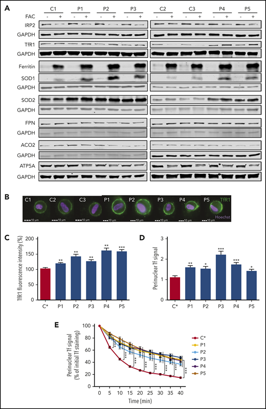FRDA fibroblasts have impaired iron uptake, accumulate TfR1 at plasma membrane, and exhibit increased transferrin endocytosis. (A) Immunoblots of proteins involved in iron homeostasis, ROS defense, and mitochondrial function in control (C1-C3) and FRDA (P1-P5) cells. Glyceraldehyde-3-phosphate dehydrogenase (GAPDH) was used as a loading control. Immunoblotting quantifications are presented in supplemental Figure 3. (B) Examples of TfR1 labeling in fibroblasts of control (C1-C3) and FRDA (P1-P5) fibroblasts. Cell analysis was based on Hoechst+ signals. Scale bar, 10 µm. (C) Quantification of membrane-bound TfR1 signal in control (C*) and FRDA (P1-P5) fibroblasts grown in regular medium, using IDEAS software (Amnis Corporation). (D) Basal fluorescence intensity of Alexa 555–Tf signal in control (C*) and FRDA (P1-P5) fibroblasts after 5 minutes of Alexa 555–Tf incubation. (E) Relative mean fluorescence intensity of Alexa 555–Tf signal for 40 minutes, after 30 minutes of incubation, for control (C*) and FRDA (P1-P5) fibroblasts. Number of cells acquired was >15 cells per experiment. All bar plots show mean ± standard error (n = 3). Analyses of variance and Student t tests were used to compare patients’ values with control mean. *P < .05, **P < .01, ***P < .001.