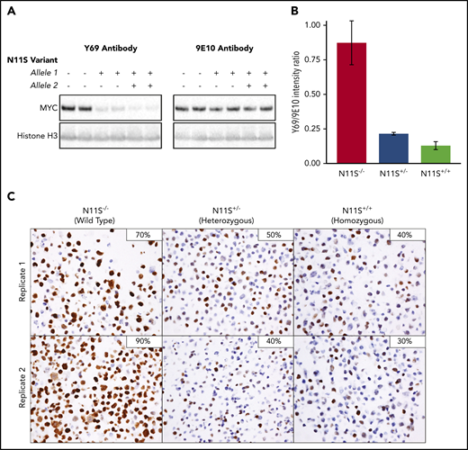 MYC-N11S polymorphism leads to disruption of the Y69 binding and reduced IHC staining. The N11S variant was modeled in DOHH-2 cells using CRISPR/Cas9. N11S−/− refers to WT cell lines, whereas N11S+/− and N11S+/+ refer to cell lines heterozygous and homozygous for the N11S variant, respectively. (A) Western blotting for MYC was performed on whole-cell extracts of N11S and WT DOHH-2 cells using the Y69 and 9E10 antibodies. Histone H3 was used as a loading control. (B) Ratio of protein detected by western blotting using the Y69 and 9E10 antibodies, normalized for loading. Error bars indicate standard error. (C) MYC IHC using the Y69 antibody on FFPE section from N11S and WT DOHH-2 cell lines (40× objective lens). The percentage of positively stained cells for each whole section is shown in the upper right corner of the images.