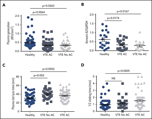 Effect of anticoagulation on plasmin generation, annexin A2 expression, and plasma CLT and CT. The data for cell surface plasmin generation (A), annexin A2 expression (B), plasma CLT (C), and plasma half-CT (D) were stratified according to anticoagulation therapy (AC) and compared with HCs. Shown are mean values ± SEM and P values derived by ANOVA and Tukey’s post hoc test of significance.