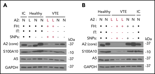 Epitope-specific immunoblotting. (A-B) Representative immunoblots depicting annexin A2, S100A10, annexin A5, and GAPDH expression in PBMCs. PBMC lysates from HCs as well as subjects with VTE and low (labeled in red) or normal A2 expression were probed with IgG directed against the core domain of A2, as well as IgGs directed against S100A10, GAPDH, and annexin A5. A sample from the same internal control (IC) was also examined in each blot. FH status, presence or absence of an IT, and presence or absence of the 5-SNP cluster are also indicated. Black dots indicate not tested. All results shown are representative of blots on samples collected on ≥2 separate occasions ≥3 months apart. L, low; N, normal.