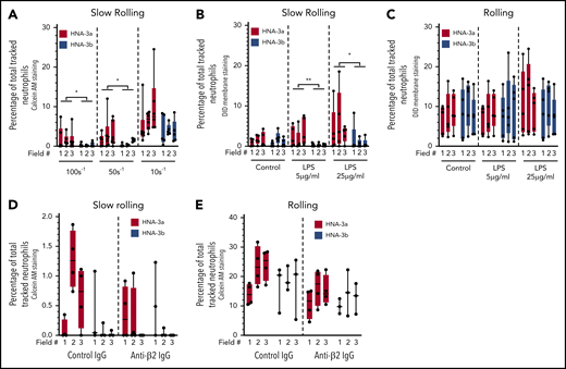Adhesion of HNA-3a–expressing neutrophils to VWF is amplified by LPS and does not require β2 integrins. (A) Percentage of total tracked neutrophils qualified as in slow rolling when perfused at 100 s−1, 50 s−1, and 10 s−1 on immobilized VWF (HNA-3a, red, n = 6 donors per condition; HNA-3b, blue, n = 6 donors for 100 s−1 and 5 donors for 50 s−1 and 10 s−1). (B-C) Percentage of total tracked neutrophils qualified as slow rolling (B) or rolling (C) when perfused at 100 s−1 on immobilized VWF after LPS treatment (5 or 25 µg/mL) prior to perfusion (n = 5 donors per condition). (D-E) Percentage of total tracked neutrophils qualified as slow rolling (D) or rolling (E) when perfused at 100 s−1 on immobilized VWF after treatment with a β2 integrin blocking IgG or a control irrelevant IgG (HNA-3a, red, n = 4 donors; HNA-3b, blue, n = 3 donors per condition). Data are represented in nested form, values obtained for each field are shown, and 3 fields were analyzed for each experiment/donor (minimum/maximum, quartiles and medians are represented; nested t test; *P < .05; **P < .01).