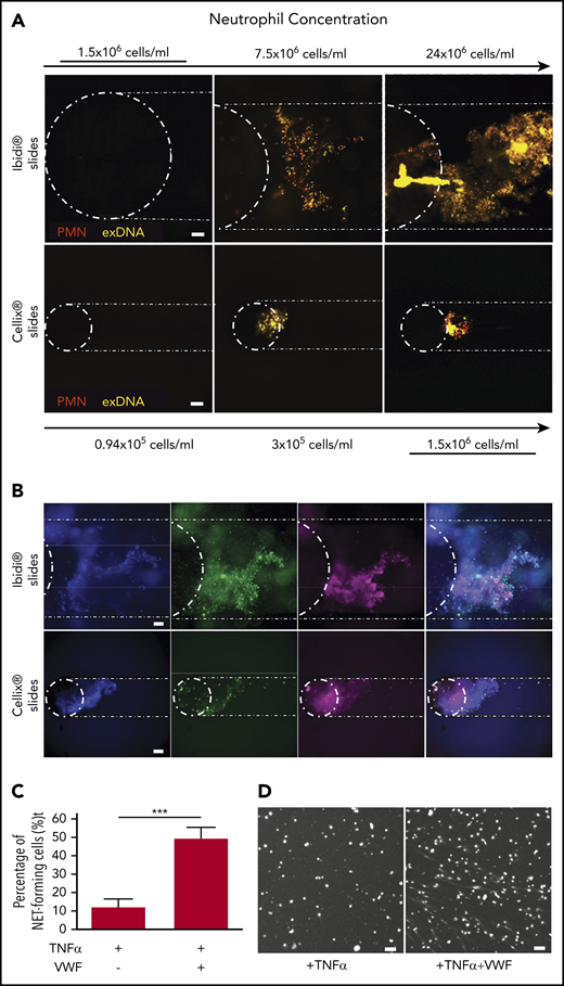 Primed neutrophils in contact with VWF can form DNA extracellular traps. (A) Representative images of fluorescently labeled LPS-primed neutrophils (PMN, red) and extracellular DNA (exDNA, yellow) after perfusion (100 s−1 shear rate) on VWF of different concentrations of neutrophils in 2 different brands of flow chambers (n = 2 donors per chamber brand). Dashed lines have been added to delimit flow channels and the well entrance. (B) Representative images of fluorescently labeled NETs at the chamber entrance showing total DNA (Hoechst 33342, blue), H3cit (green), and MPO (pink) staining after perfusion of neutrophils in Ibidi slides at 24 × 106 cells per mL (upper panel, n = 3 donors and 9 channels) and in Cellix slides at 1.5 × 106 cells per mL (lower panel, n = 2 donors and 4 channels) (C-D) Quantification of NETs after VWF challenge by fluorescence microscopy analysis. HNA-3a+ neutrophils were primed with TNFα (to mimic LPS activation) and incubated for 180 minutes with PBS (+TNFα) or VWF (+TNFα+VWF). DNA release was visualized after DNA staining with Hoechst 33342 (n = 9 fields per well, 3 wells per condition, 2 independent experiments) (mean ± SD; ***P < .005). (D) Representative fluorescence images from quantifications shown in panel C. Scale bars, 100 µm.