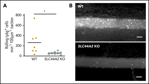 Slc44a2 is essential for neutrophil recruitment at the vessel wall following endothelial activation. Intravital microscopy was performed on mesenteric venules of mice deficient in Slc44a2 protein (SLC44A2 KO mice) after intraperitoneal histamine challenge. (A) Quantification of neutrophil rolling on mesenteric venules in wild-type (WT) and SLC44A2 KO mice (wild-type, orange circles, n = 7 venules in 3 mice; SLC44A2 KO, green circles n = 8 venules in 3 mice). (B) Representative images showing reduced neutrophil recruitment in mesenteric venules of SLC44A2 KO mice after staining of endogenous rolling neutrophils by infusion of an Alexa Fluor 660-anti-Ly6g antibody (bars represent means; *P < .05). Scale bars, 100 µm.