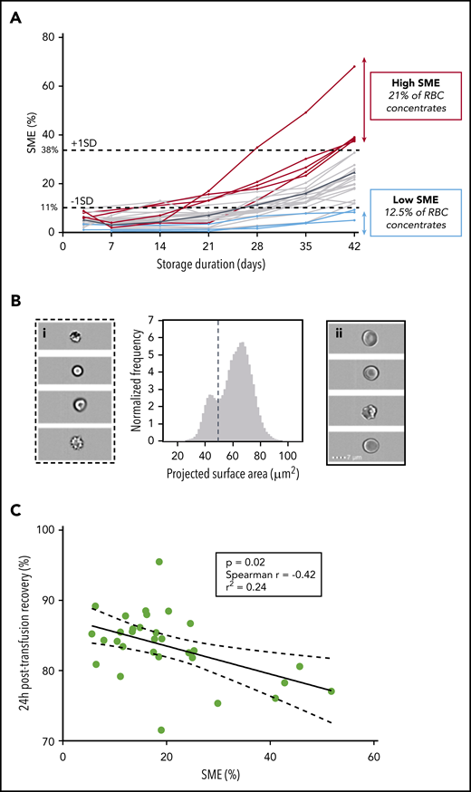Proportion of SMEs at the end of storage correlates with 24-hour posttransfusion recovery in healthy human volunteers. (A) Quantification of SMEs upon storage of RBC concentrates in SAGM solution (n = 24) between days 3 and 42 (mean value in solid black line). Low (blue lines) and high proportions of SMEs (red lines) defined by proportions of SME < −1 SD (11%) and > +1 SD (38%) at the end of storage, respectively. (B) Representative normalized frequency plot for RBC concentrate at the end of storage in AS-3 showing a well-demarcated subpopulation of SMEs. Subpopulation of SMEs contains spherocytes, spheroechinocytes, and type III echinocytes (i), whereas normal-sized RBCs (ii) contain discocytes and type I and II echinocytes. (C) Correlation between 24-hour posttransfusion recovery and proportions of SMEs quantified by imaging flow cytometry at the end of storage (n = 31; P = .02; Spearman r = −0.42; r2 = 0.24).