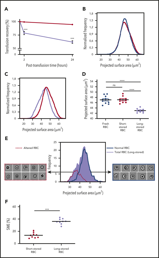 Identification and quantification of a subpopulation of SMEs in a mouse model. (A) Posttransfusion recovery of long-stored RBCs (14 days of storage; lavender line; n = 7) is decreased at 2 and 24 hours after transfusion to control recipients compared with short-stored RBCs (1 day of storage; red line; n = 7). (B) Normalized frequency plots of projected surface area for fresh (purple line; n = 11) and short-stored RBCs (red line; n = 9) show similar patterns. (C) Long-stored RBCs (lavender line; n = 9) have a reduced projected surface area compared with short-stored RBCs (red line). (D) Quantification of projected surface area of front views of focused RBCs obtained by imaging flow cytometry shows a significant decrease in long-stored RBCs. (E) Representative analysis of brightfield images of long-stored RBCs shows that morphologically altered RBCs (dashed red line) have a reduced projected surface area compared with RBCs with normal morphology (blue line). Morphologically altered RBCs defined as type III echinocytes, spheroechinocytes, spherostomatocytes, and spherocytes, whereas normal RBCs comprised discocytes and type I and II echinocytes. (F) SMEs in short- and long-stored RBCs accumulate during storage. Data are presented as means ± standard errors of the mean. ***P < .001, ****P < .0001 by Sidak multiple comparisons test comparing, at each time point, recovery of short- vs long-stored RBCs (A), by Tukey multiple comparisons test comparing projected surface area for each condition (D), or by Student t test comparing proportion of SMEs in short-stored vs long-stored RBC (F). ns, not significant.